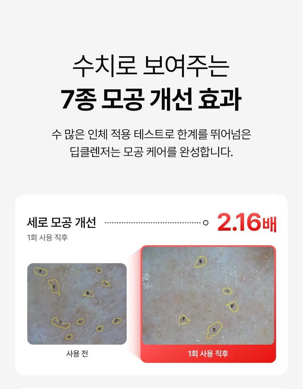 [모공쏙폼] 메디필 레드 락토 콜라겐 클리어 폼 2.0 대용량 300ml 기획 (+해면) 상세페이지 23